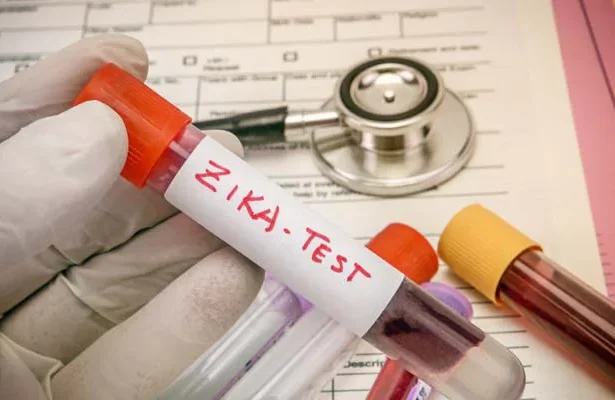 Pune Doctor and Daughter Test Positive for Zika Virus